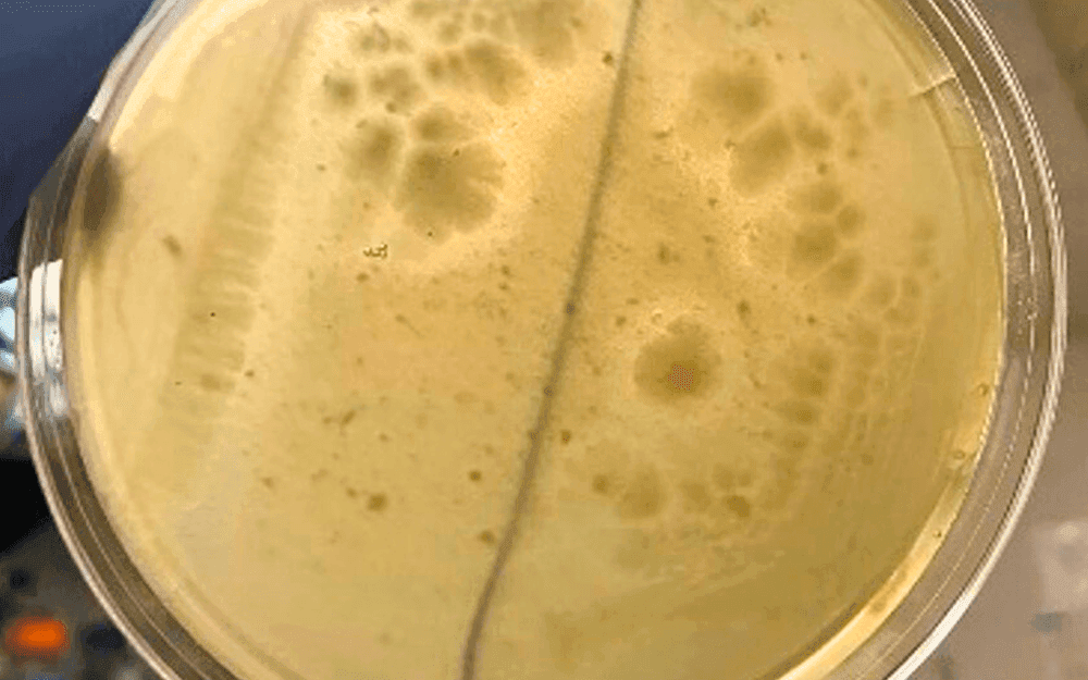 Las bacterias de la boca podrían reducir las reacciones alérgicas al cacahuete según un estudio con participación de la UFV Editado_Placa con bacterias humanas degradadoras de cacahuete Las bacterias de la boca podrían reducir las reacciones alérgicas al cacahuete según un estudio con participación de la UFV Estudiar en Universidad Privada Madrid